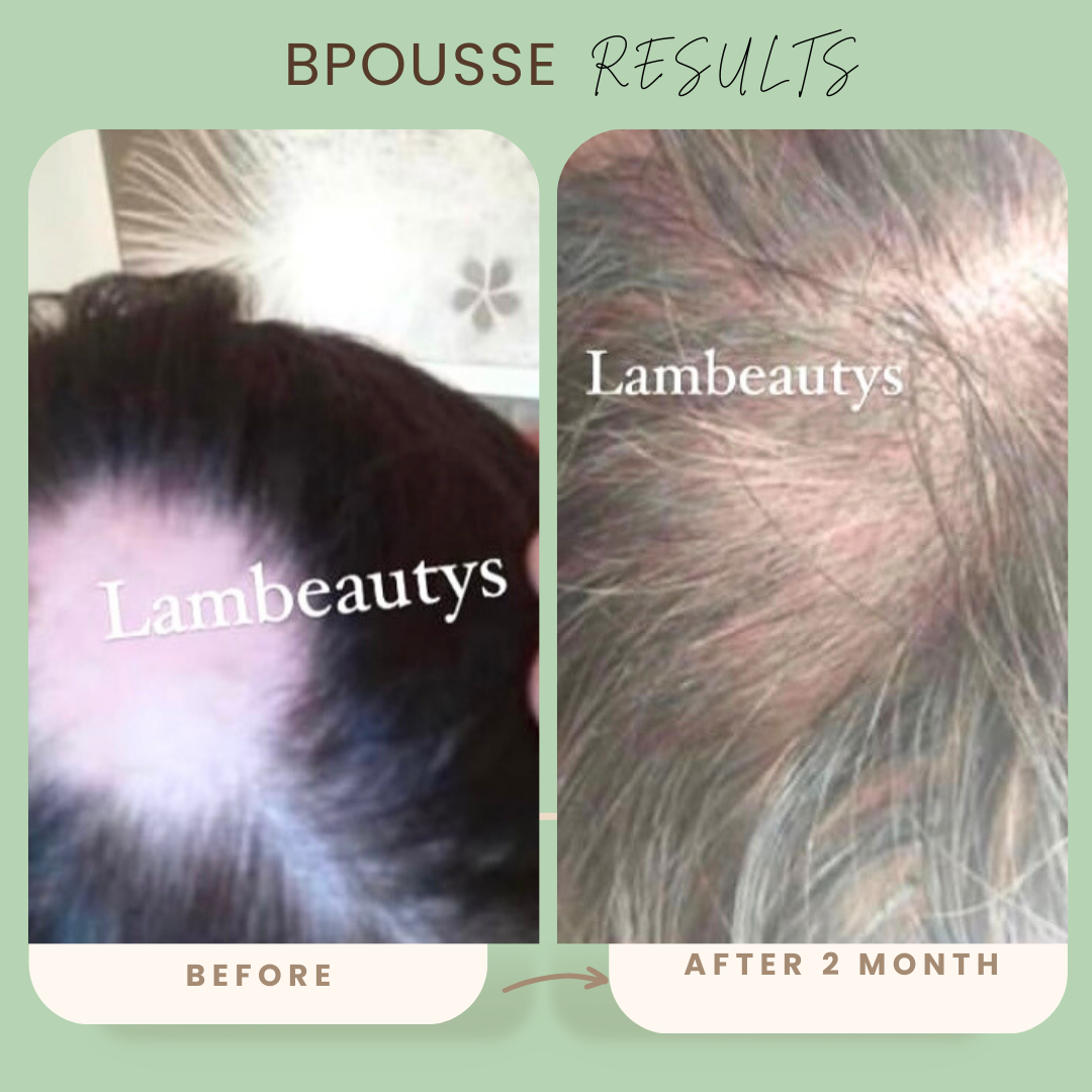 Bpousse originale