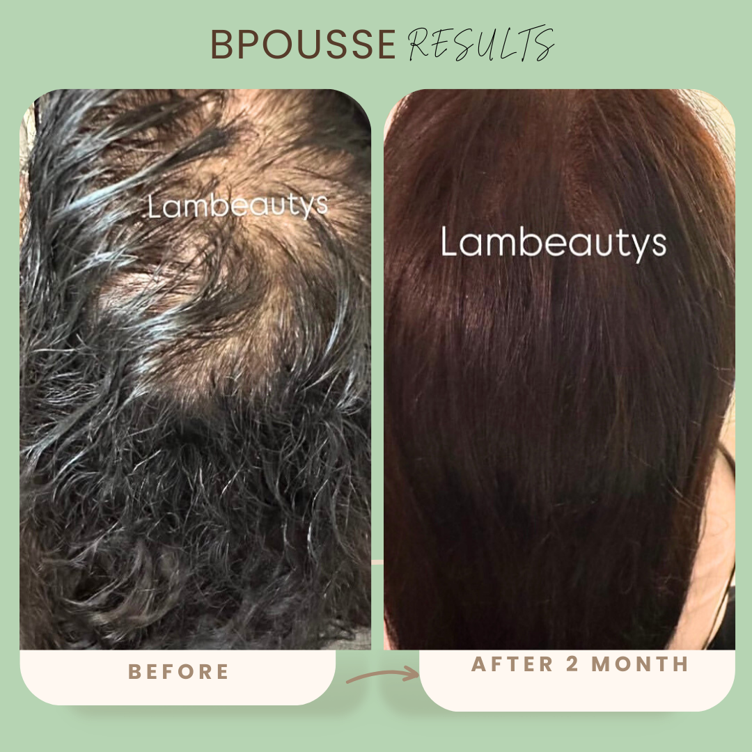 Bpousse originale