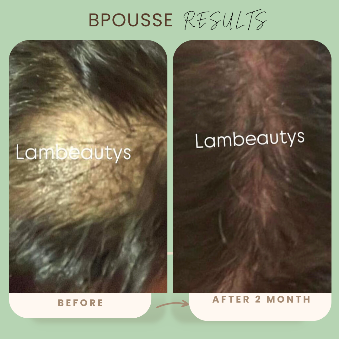 Bpousse originale