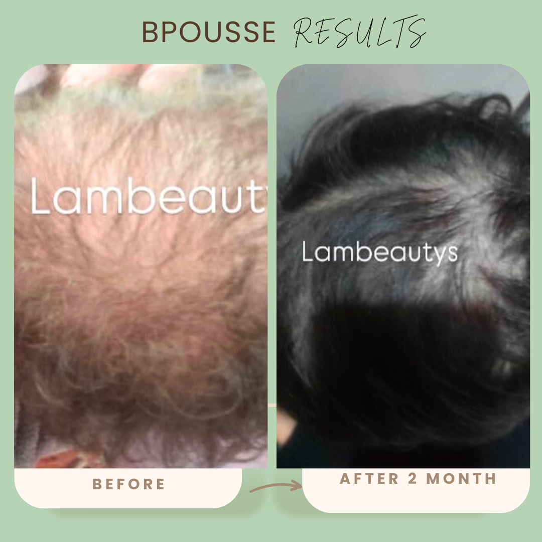 Bpousse originale