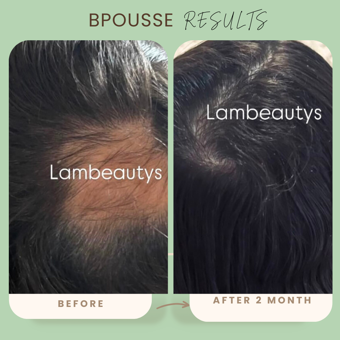 Bpousse originale