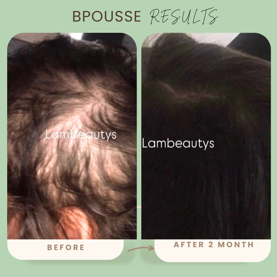 Bpousse originale