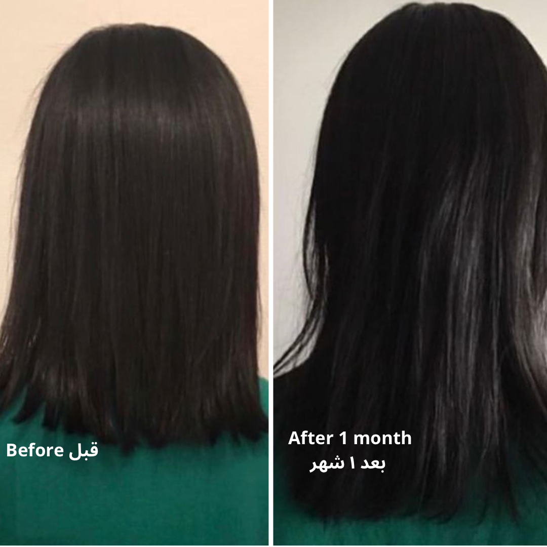 Bpousse hair growth lotion